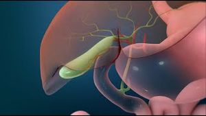 Video post by @nucleusmedicalmedia on YouTube