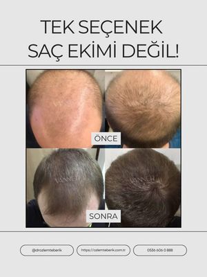 Image post by @drozlemteberik on Instagram