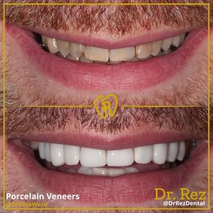 Image post by @drrezdental on Facebook
