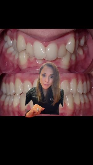 Video post by @weisstorortho on TikTok