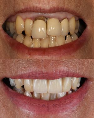 Image post by @fahaddentist on Instagram