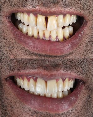 Image post by @fahaddentist on Instagram