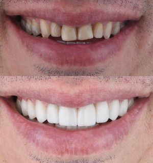 Image post by @sharpdentistry on Instagram