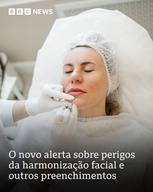 Image post by @bbcbrasil on Instagram