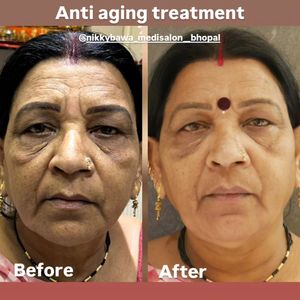 Image post by @nikkybawamedisalonbhopal on Instagram