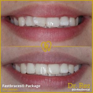 Image post by @drrezdental on Facebook