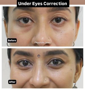 Image post by @nikkybawamedisalonbhopal on Instagram