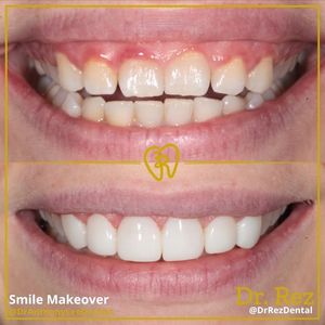 Image post by @drrezdental on Facebook
