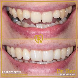 Image post by @drrezdental on Facebook