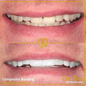 Image post by @drrezdental on Facebook
