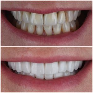 Image post by @sharpdentistry on Instagram