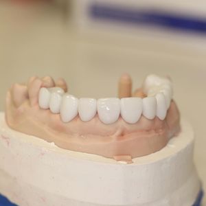Image post by @fahaddentist on Instagram