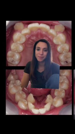Video post by @weisstorortho on TikTok