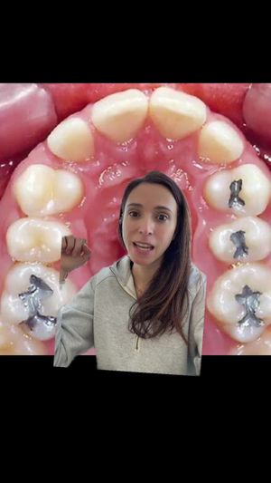 Video post by @weisstorortho on TikTok