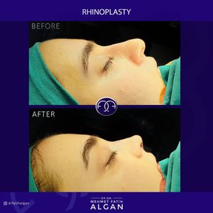 Image post by @drfatihalgan on Instagram