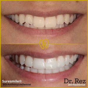 Image post by @drrezdental on Facebook