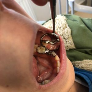 Image post by @dentamerzifon on Instagram