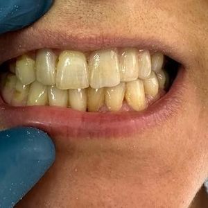 Image post by @dentamerzifon on Instagram