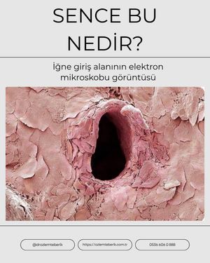 Image post by @drozlemteberik on Instagram