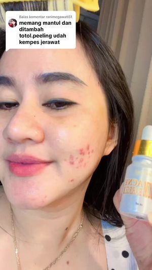 Video post by @lili.refliskin on TikTok
