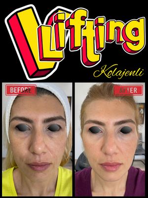 Image post by @drozlemteberik on Instagram