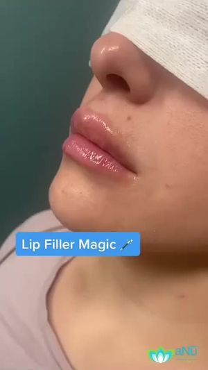 Video post by @anuaestheticsandwellness on Instagram