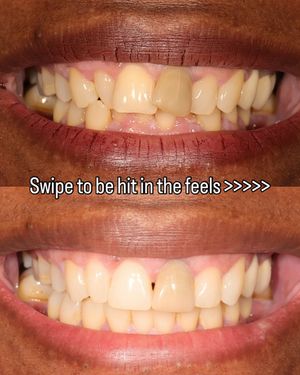 Image post by @fahaddentist on Instagram