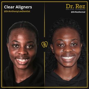 Image post by @drrezdental on Facebook