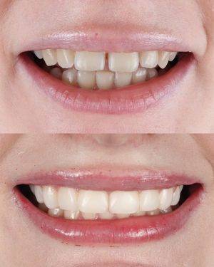 Image post by @fahaddentist on Instagram