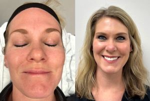 Image post by @alignedsurgery on Instagram