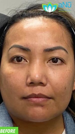 Video post by @anuaestheticsandwellness on Instagram