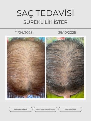 Image post by @drozlemteberik on Instagram