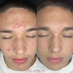 Image post by @HessBeautyBar on Facebook