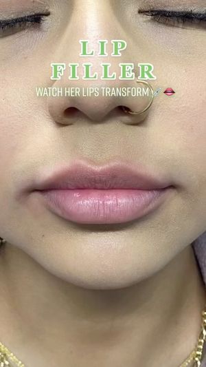 Video post by @anuaestheticsandwellness on Instagram