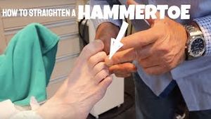 Video post by @thebunionking on YouTube