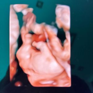 Image post by @dr.aliriogrisanti on Instagram