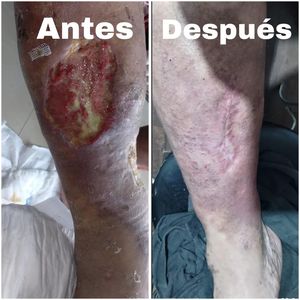 Image post by @dr.vicentevascular on Instagram