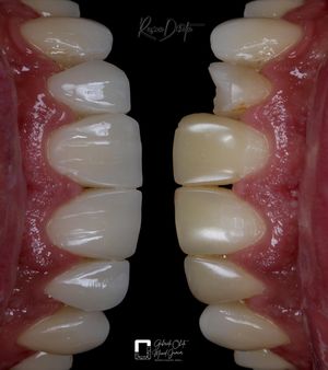Image post by @dr.maciel_junior on Instagram