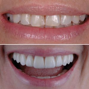 Image post by @sharpdentistry on Instagram