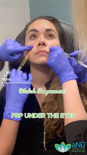 Video post by @anuaestheticsandwellness on Instagram