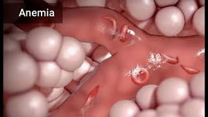 Video post by @nucleusmedicalmedia on YouTube