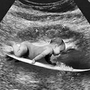 Image post by @sportv on Instagram