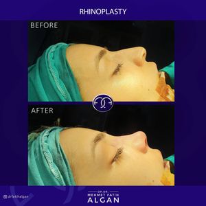 Image post by @drfatihalgan on Instagram