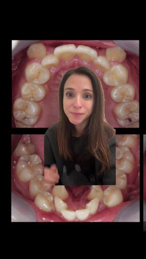 Video post by @weisstorortho on TikTok