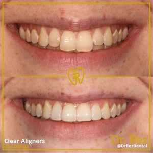 Image post by @drrezdental on Facebook