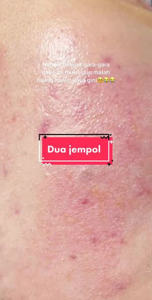 Video post by @lili.refliskin on TikTok