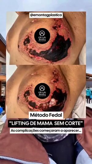 Video post by @drabeleza on Instagram