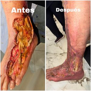 Image post by @dr.vicentevascular on Instagram