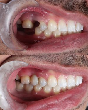Image post by @fahaddentist on Instagram