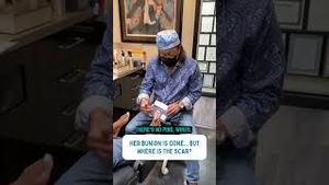Video post by @thebunionking on YouTube